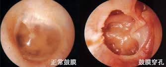 白癜风会出现哪些症状