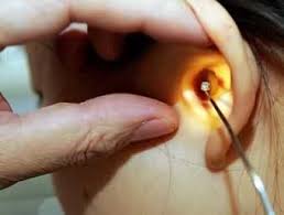 白癜风最好的治疗方法是什么