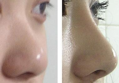 白癜风有哪些严重危害?怎么治疗