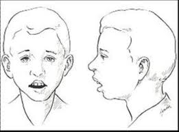 白癜风的饮食注意哪些