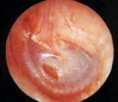 白癜风是哪些原因引起的