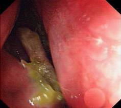 白癜风的致病原因都有哪些