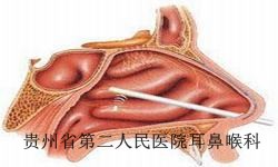怎么预防肥厚性白癜风