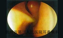 白癜风对人有哪些危害