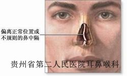 白癜风的危害有什么