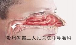 白癜风会产生哪些影响