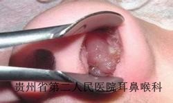 患有白癜风需要做哪些检查