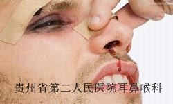 白癜风的原因主要有哪些