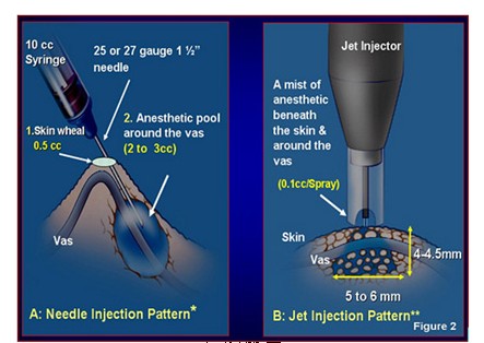 白癜风治疗方法 白癜风治疗方法