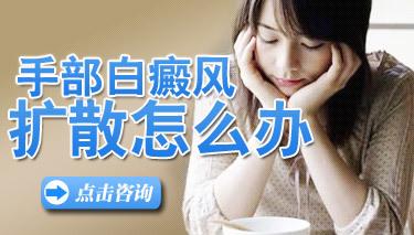 预防手部白癜风扩散要注意什么