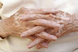 白癜风防治注意事项有哪些