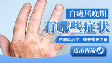 武汉能把白癜风治好的医院有哪些