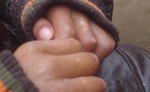 武汉治疗白癜风青睐帅海林