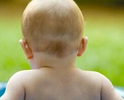 初期白癜风怎么治疗最有效 白癜风初期如何治疗起效快