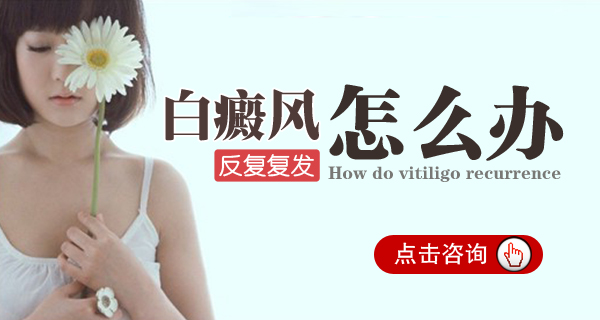 刚确诊的白癜风有希望治好吗 女性脸部得了白癜风要怎么做
