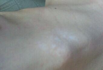 咸宁白斑病医院环亚规范 咸宁白斑医院病环亚仔细