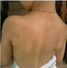 白癜风要怎样才能更好的治疗呢?武汉看白癜风专科医院? 有助于白癜风治疗的方法是哪些?武汉看白癜风的医院哪个好?