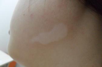 ŮôЧԤ磿人ҽԺã