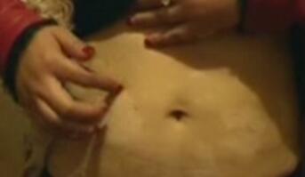 武汉白癜风治疗正规医院?白癜风日常护理要怎么做呢 武汉白癜风治疗专业的医院?白癜风治疗一般要注意哪些重点