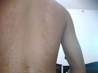 武汉哪个医院可以治疗白斑?为什么治疗白癜风一定要及时 武汉白癜风治疗哪个医院好?身上的白癜风可以治好吗