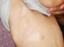 武汉专治白癜风医院?面部患上白癜风该如何治疗 武汉治白癜风去哪里?要怎样治疗白癜风效果好