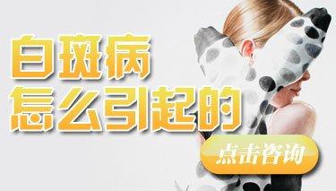 武汉造成白癜风反复发作的原因有哪些?